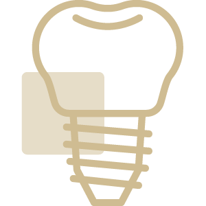 Implantes Dentários